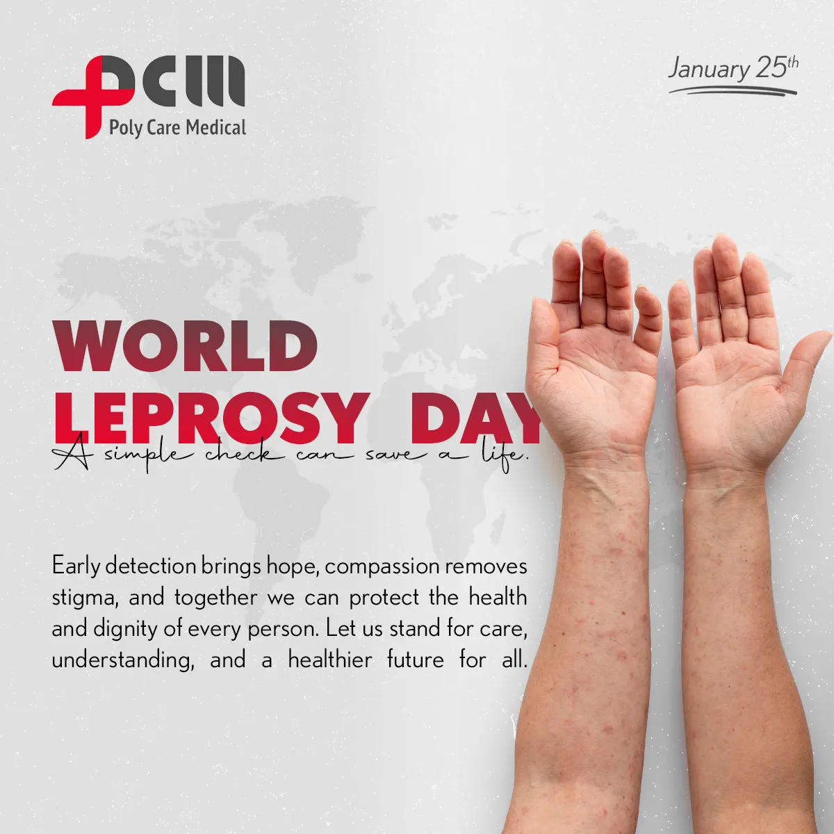 World Leprosy Day